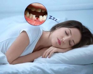 Giải mã giấc mơ thấy rụng răng không chảy máu chi tiết